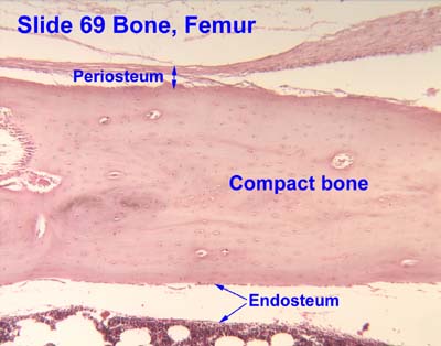 woven-bone-histology